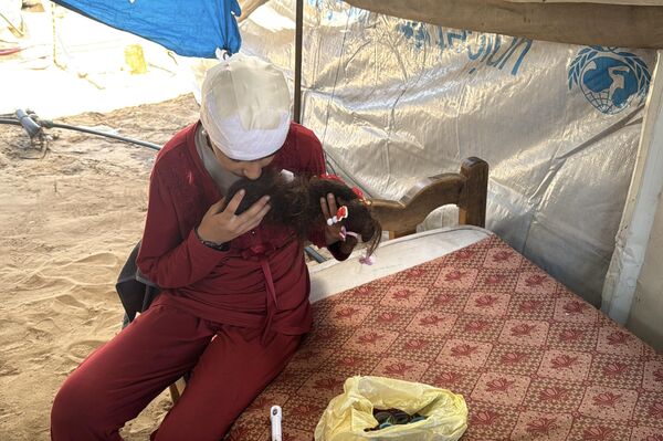 طفلة فلسطينية تحلم بعودة شعرها الذي أحرقته قذائف الحرب  - سبوتنيك عربي