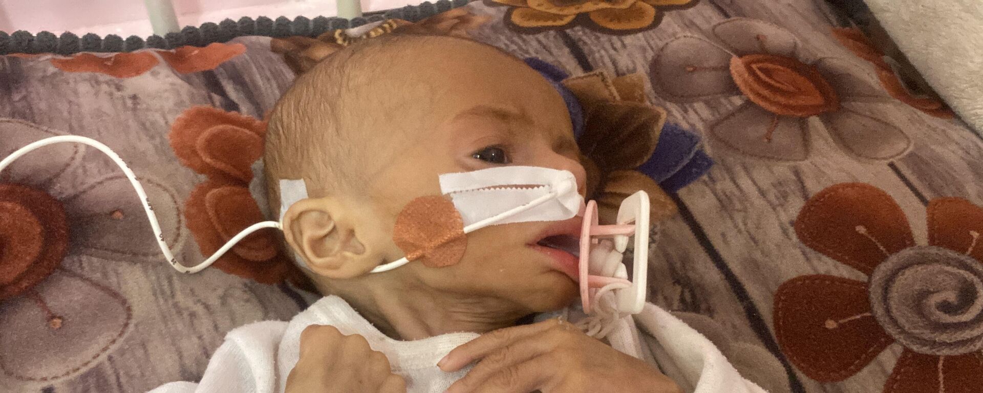 الجوع يفتك بأطفال غزة ومعاناة عشرات الآلاف من الفلسطينيين بسبب سوء التغذية - سبوتنيك عربي, 1920, 25.07.2025