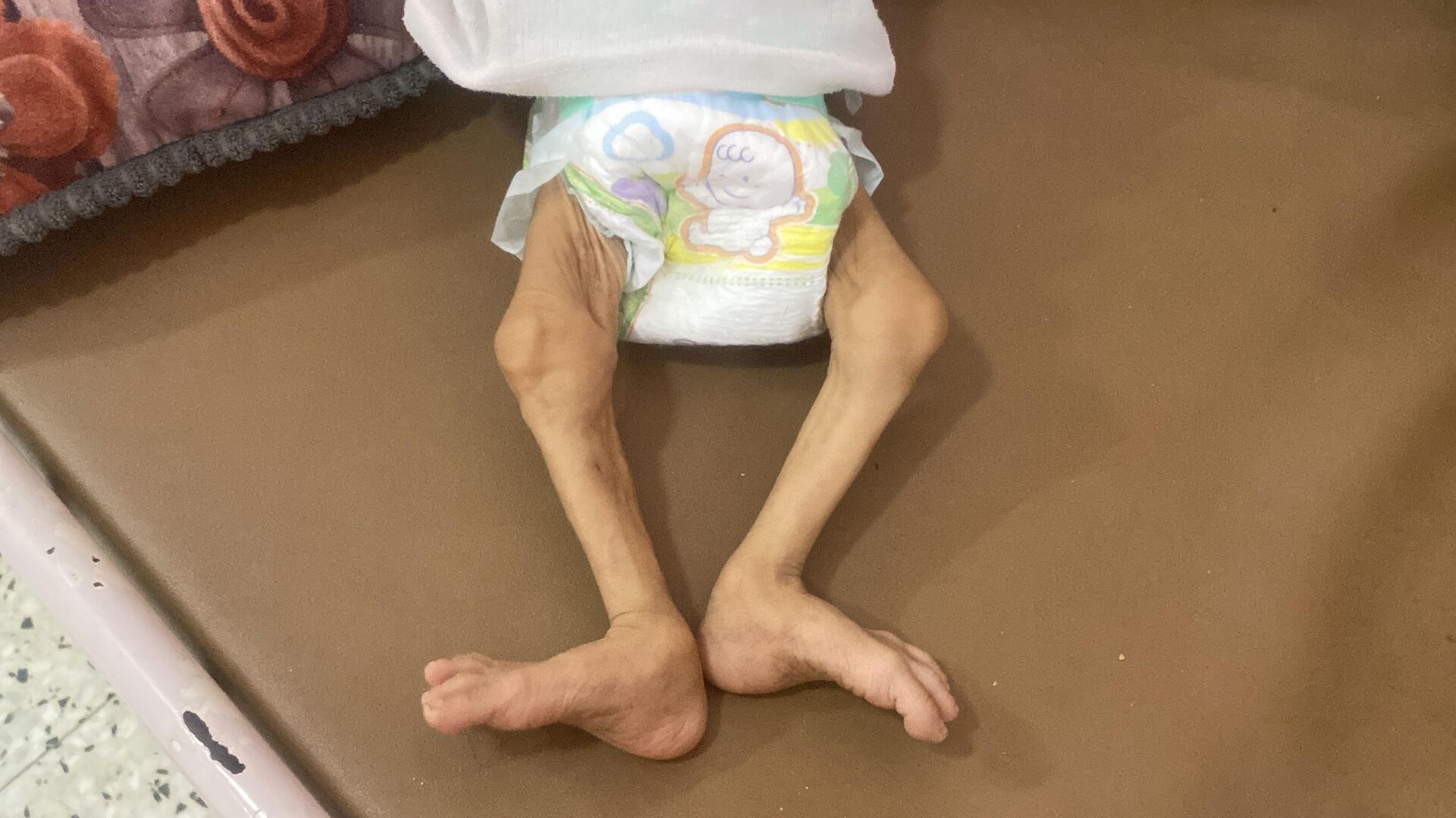 الجوع يفتك بأطفال غزة  - سبوتنيك عربي, 1920, 25.07.2025