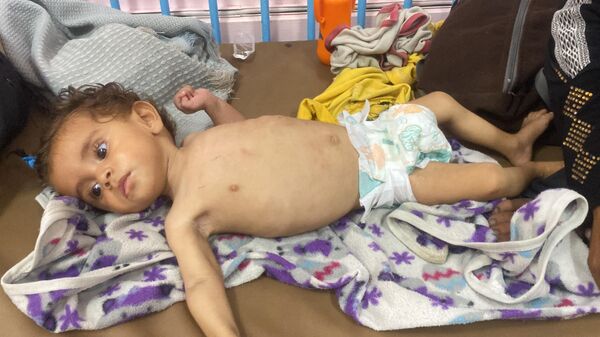 الجوع يفتك بأطفال غزة  - سبوتنيك عربي