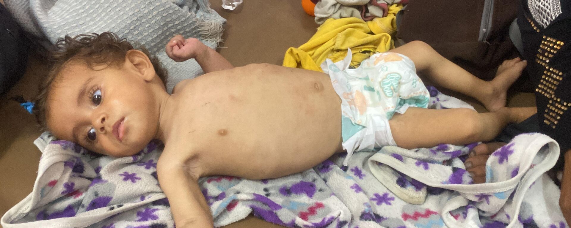 الجوع يفتك بأطفال غزة  - سبوتنيك عربي, 1920, 27.07.2025