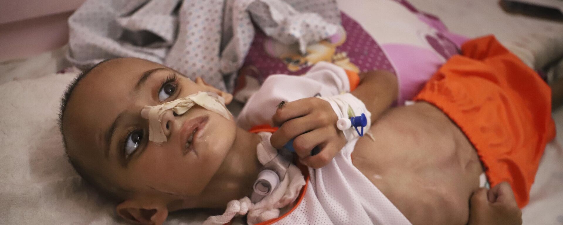 وضع الخدمات الصحية في غزة وتأثيرها على الأطفال - سبوتنيك عربي, 1920, 05.08.2025