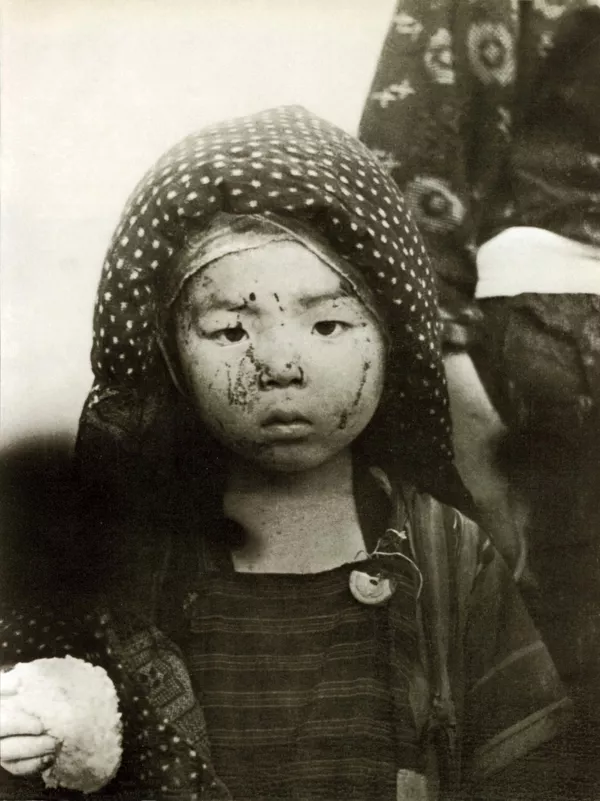 إحدى ضحايا القنبلة الذرية على ناغازاكي، عام 1945 إحدى ضحايا القنبلة الذرية على ناغازاكي، عام 1945 - سبوتنيك عربي