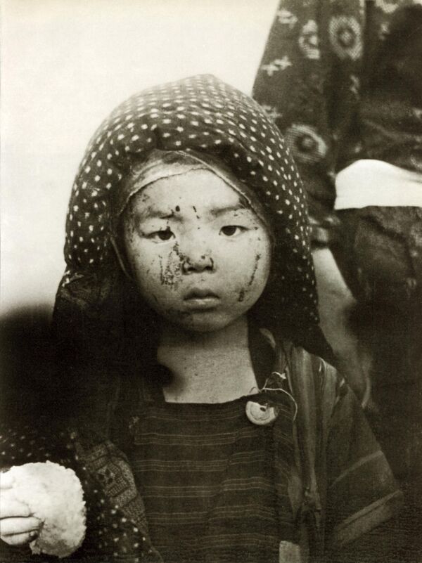 إحدى ضحايا القنبلة الذرية على ناغازاكي، عام 1945 - سبوتنيك عربي