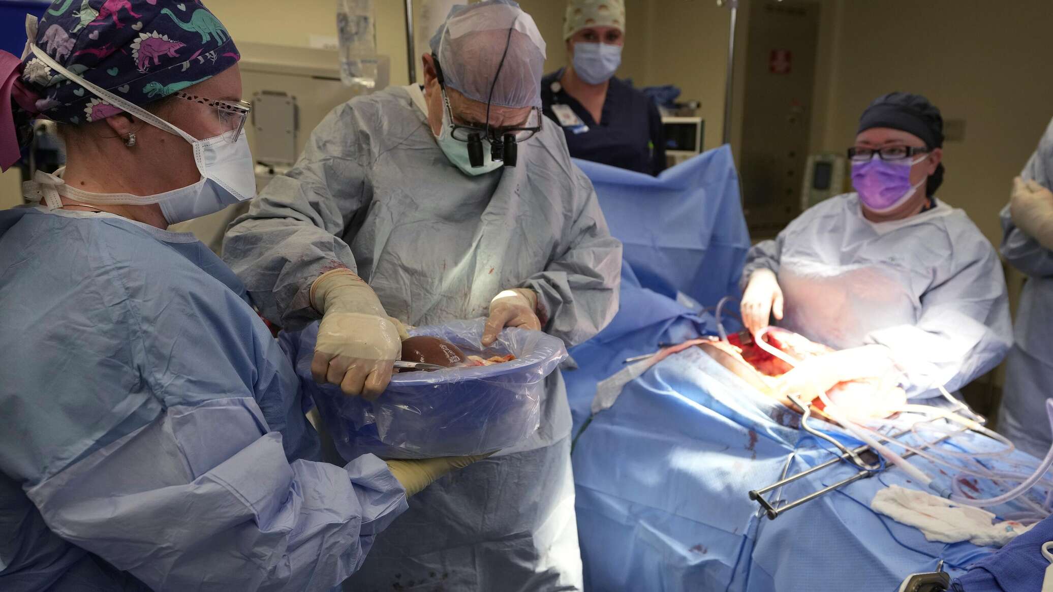 زراعة رئة خنزير في جسد إنسان لأول مرة في تاريخ الطب