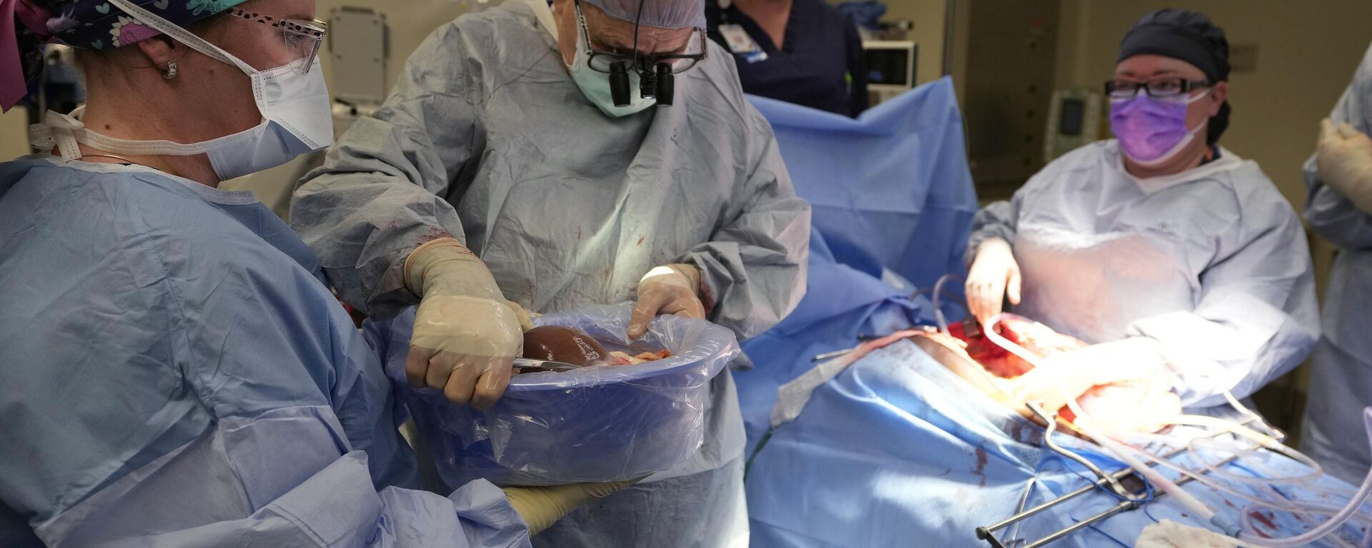 زراعة الأعضاء - سبوتنيك عربي, 1920, 26.08.2025