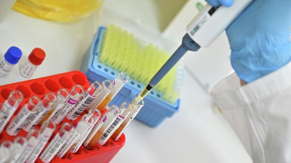 روسيا تسجل دواء مبتكرا لعلاج سرطان الرئة  - سبوتنيك عربي