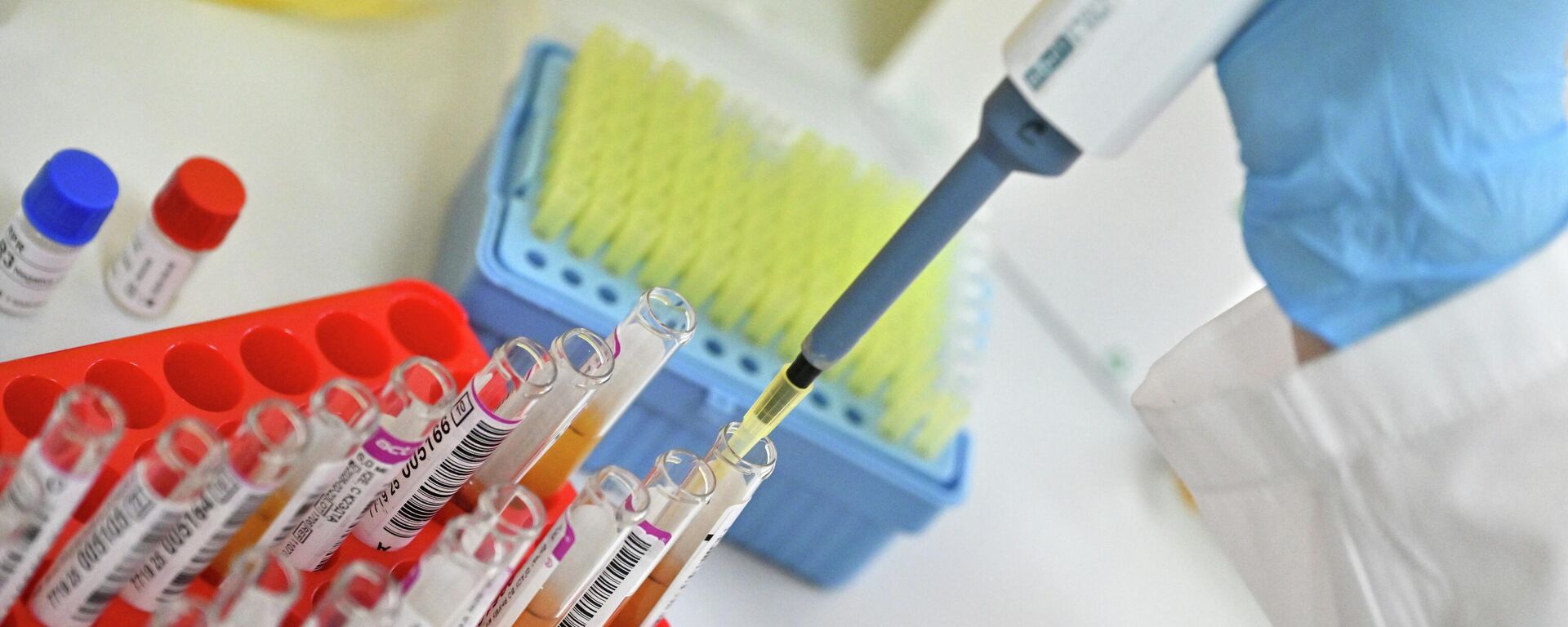 روسيا تسجل دواء مبتكرا لعلاج سرطان الرئة روسيا تسجل دواء مبتكرا لعلاج سرطان الرئة - سبوتنيك عربي, 1920, 10.12.2025