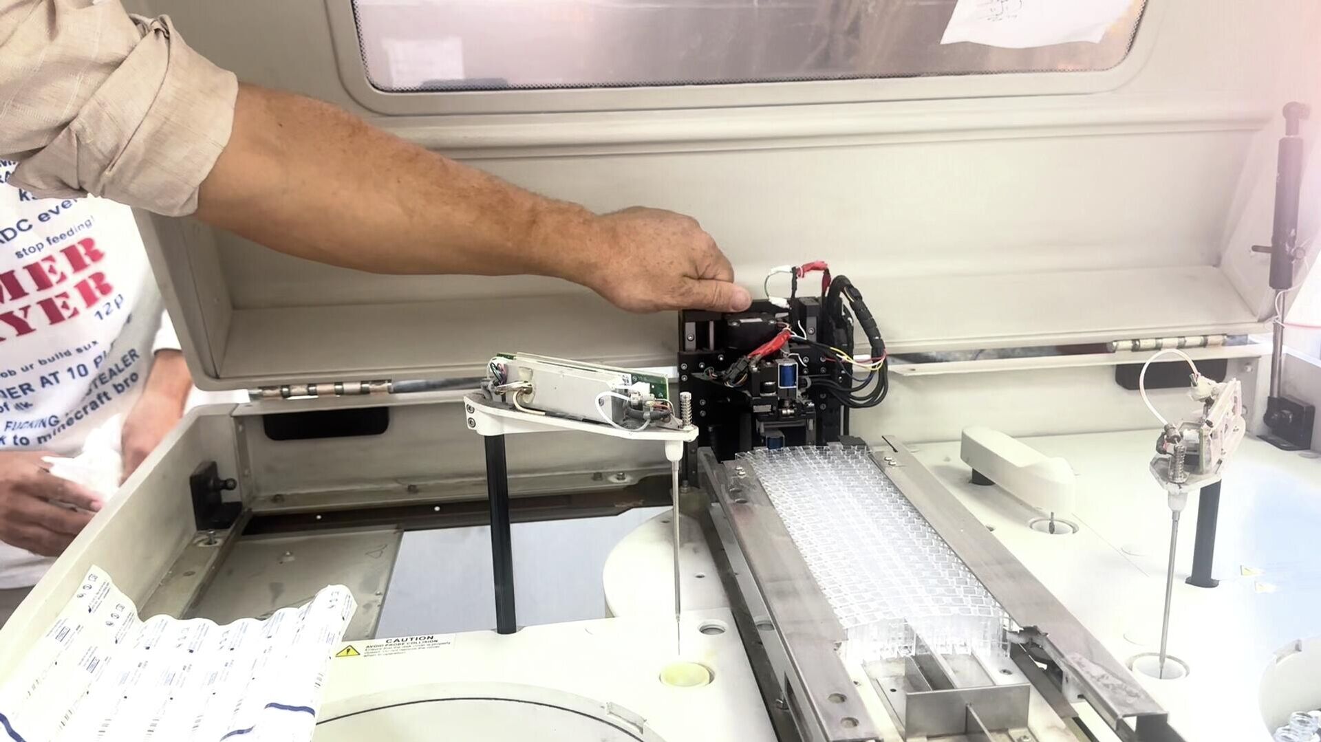 نقص حاد في مخزون المستهلكات المختبرية يعيق فحوصات المرضى والجرحى في غزة - سبوتنيك عربي, 1920, 11.12.2025