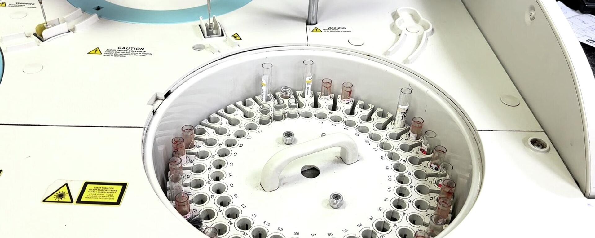 نقص حاد في مخزون المستهلكات المختبرية يعيق فحوصات المرضى والجرحى في غزة - سبوتنيك عربي, 1920, 12.12.2025