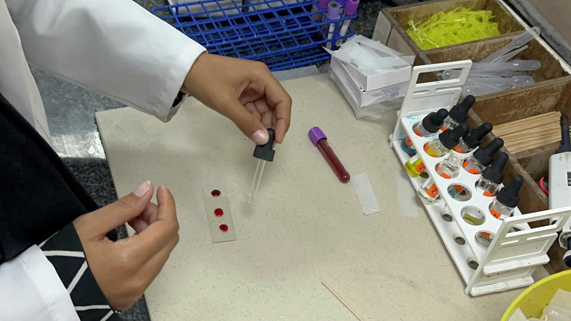 نقص حاد في مخزون المستهلكات المختبرية يعيق فحوصات المرضى والجرحى في غزة - سبوتنيك عربي, 1920, 11.12.2025