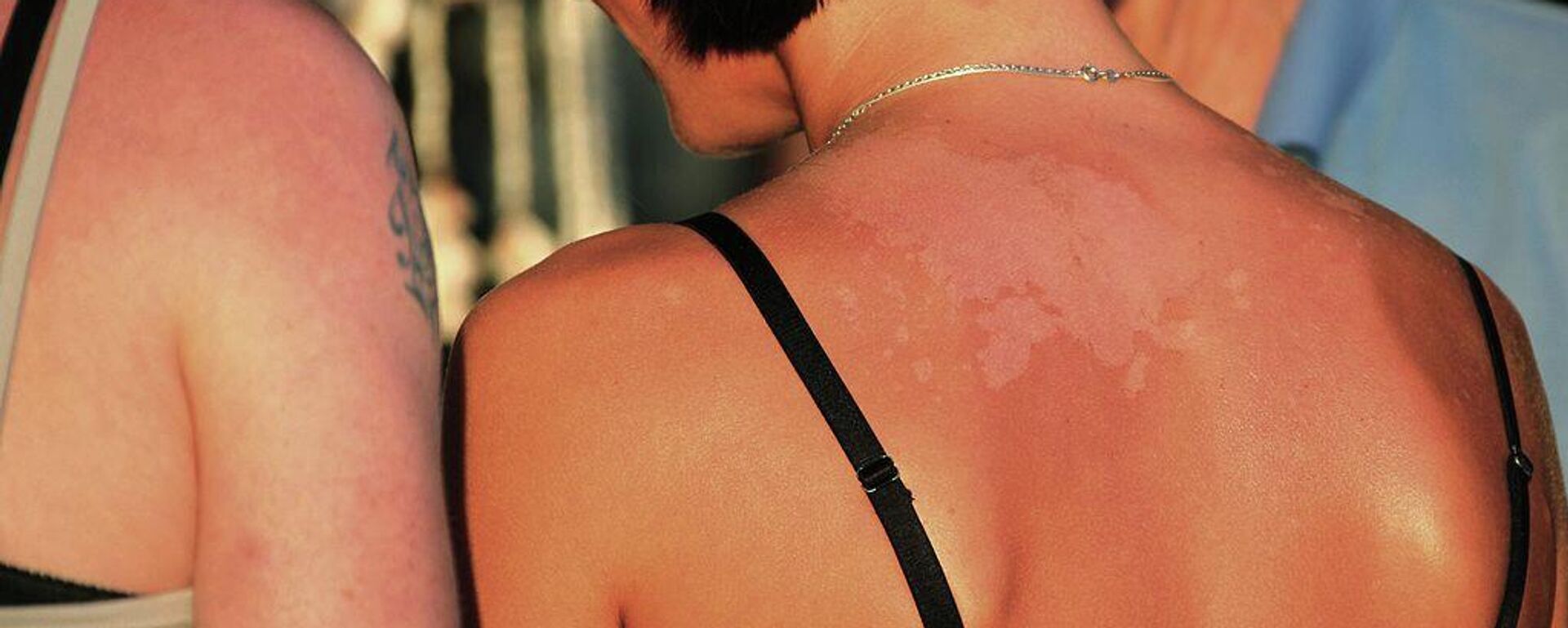 كيف تُسرع أجهزة التسمير شيخوخة البشرة على المستوى الجيني - سبوتنيك عربي, 1920, 20.12.2025