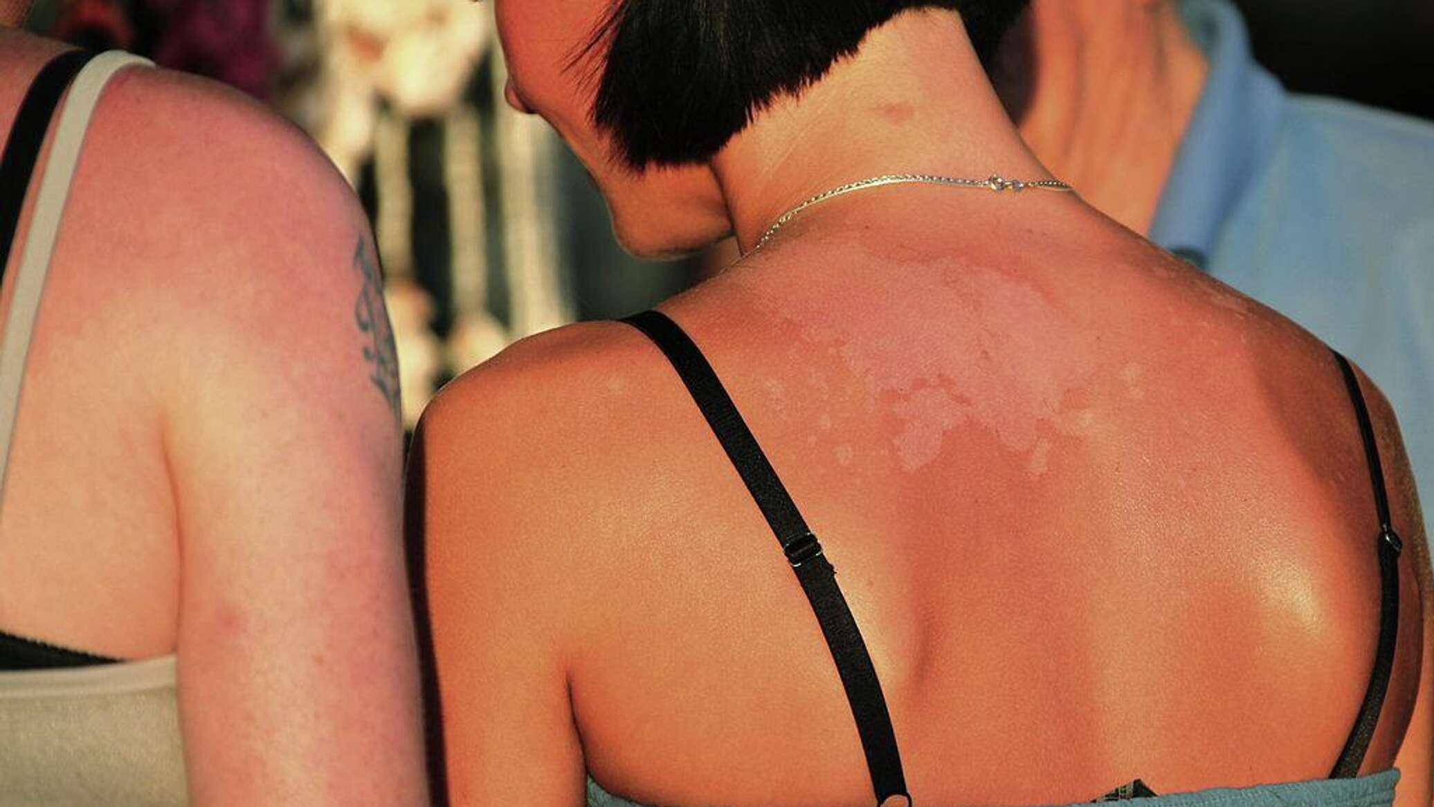 علماء يكشفون كيف تسرع أجهزة "التسمير" شيخوخة البشرة على المستوى الجيني