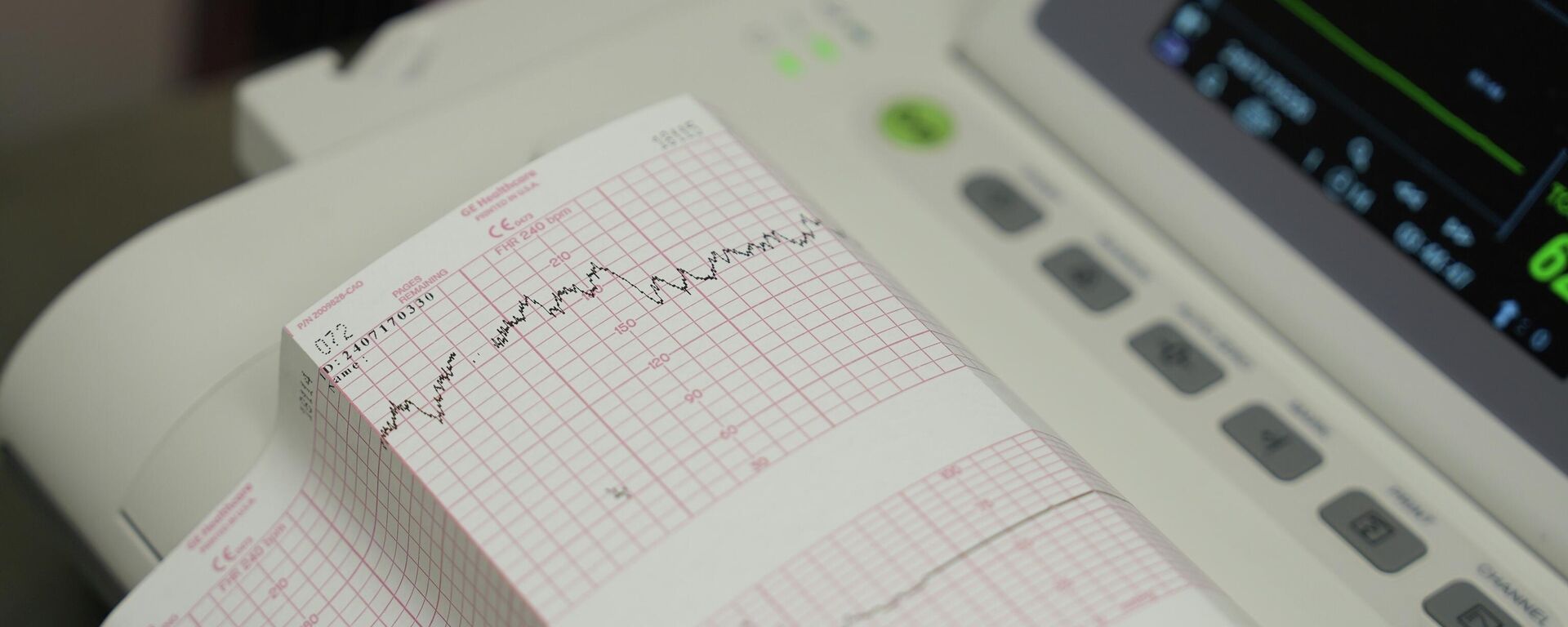 أمراض القلب - سبوتنيك عربي, 1920, 26.02.2026