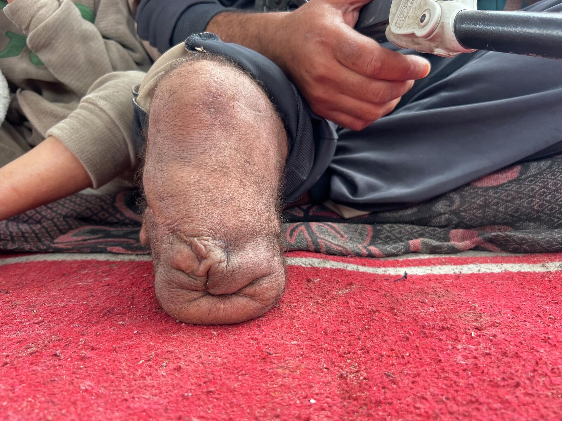 محمود الزربة يقاوم العتمة والعجز ويتشبث بالحياة داخل خيمته المهترئة في غزة   - سبوتنيك عربي, 1920, 29.04.2026