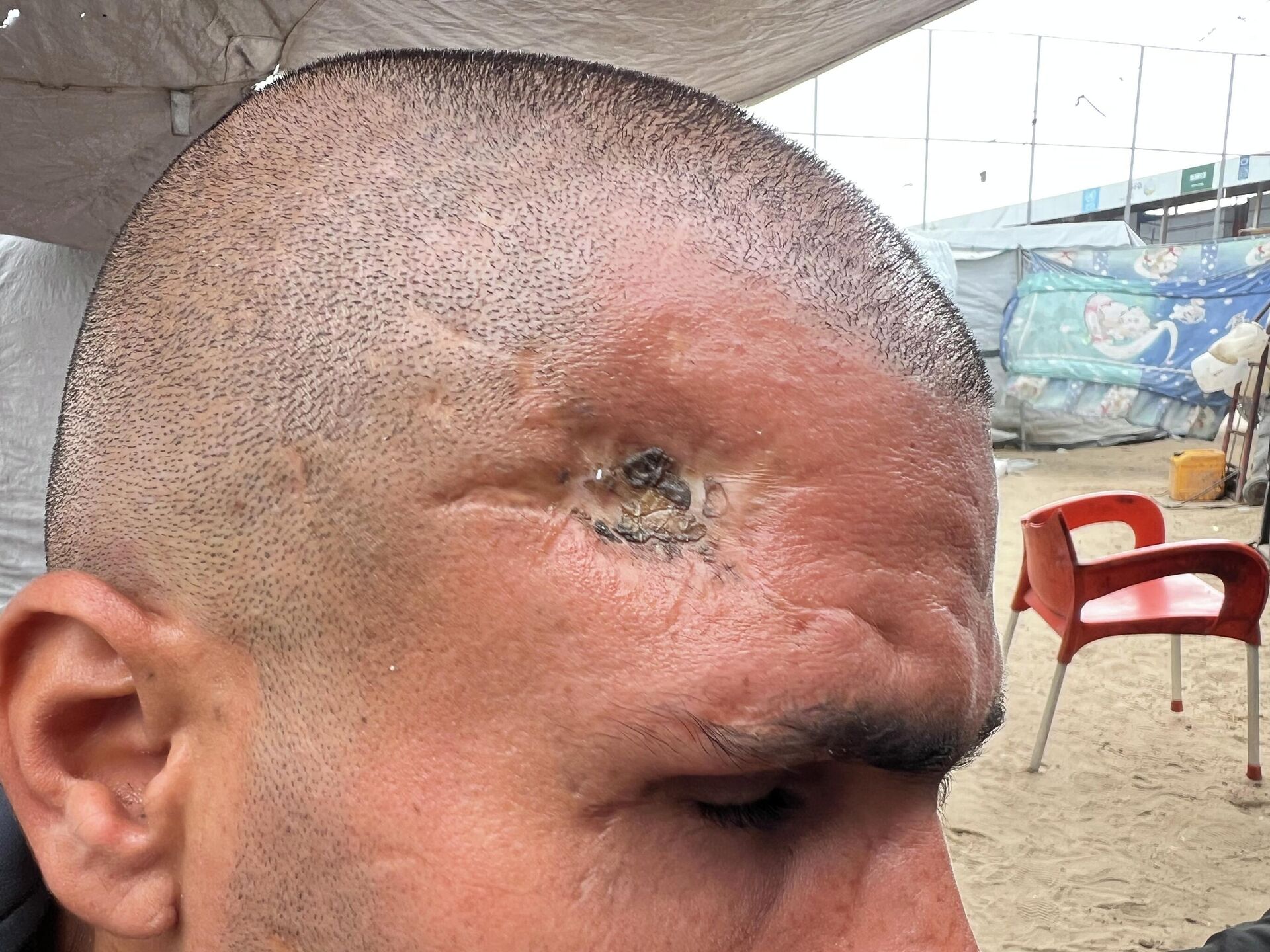 محمود الزربة يقاوم العتمة والعجز ويتشبث بالحياة داخل خيمته المهترئة في غزة   - سبوتنيك عربي, 1920, 29.04.2026