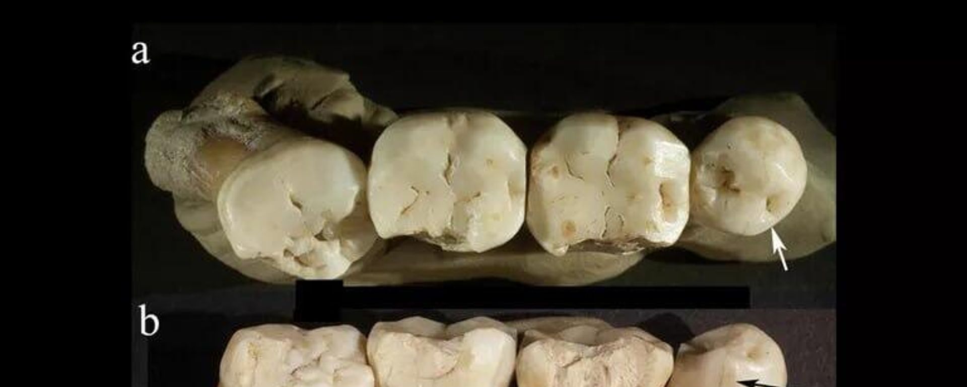 © Источник: David W. Frayer et al. Prehistoric dentistry? P4 rotation, partial M3 impaction, toothpick grooves and other signs of manipulation in Krapina Dental Person 20. Bulletin of the International association for paleodontology, Vol. 11 No. 1, 2017 - سبوتنيك عربي, 1920, 14.05.2026