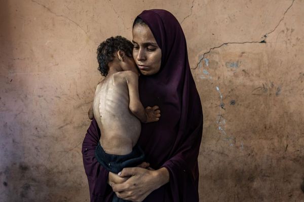 بين ذراعي والدته، يعاني الطفل الفلسطيني يزن أبو فول، البالغ عامين، من سوء تغذية حاد في ظل تدهور الأوضاع المعيشية في قطاع غزة، ومع فقدان منزلهما في مخيم الشاطئ غربي مدينة غزة، تكافح الأسرة لتأمين الغذاء والمأوى وسط ظروف إنسانية قاسية. - سبوتنيك عربي