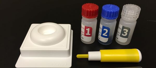 لقاح ملاريا لقاح ملاريا - سبوتنيك عربي