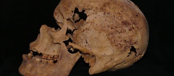 أعلنت وزارة الآثار المصرية، الثلاثاء، اكتشاف أقدم حالات الإصابة بسرطان الثدي لدى سيدة عاشت إبان عصر الأسرة السادسة، سنة 2200 ق.م - سبوتنيك عربي