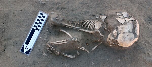 هيكل طفل مريض بمرض الاسقربوط هيكل طفل مريض بمرض الاسقربوط - سبوتنيك عربي