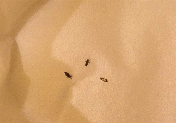 لماذا تشتري نساء الكويت القمل الحي؟ - سبوتنيك عربي