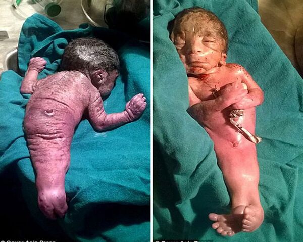 ولادة عروس بحر حقيقية ولادة عروس بحر حقيقية - سبوتنيك عربي