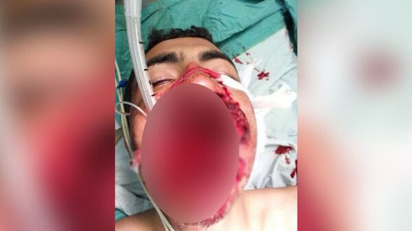 شقيق المواطن السعودي بعد مهاجمة الجمل له - سبوتنيك عربي