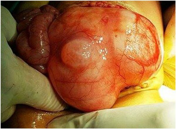 الجنين - سبوتنيك عربي