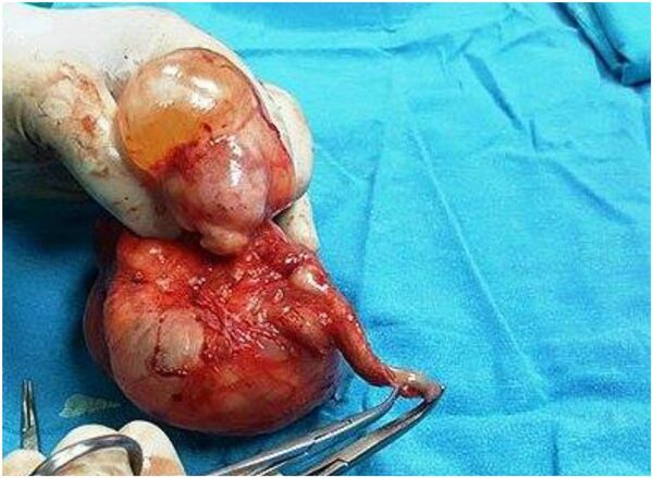 الجنين - سبوتنيك عربي