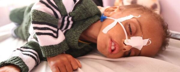 أطفال اليمن - سبوتنيك عربي