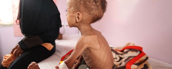 أطفال اليمن - سبوتنيك عربي