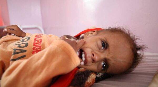 أطفال اليمن - سبوتنيك عربي