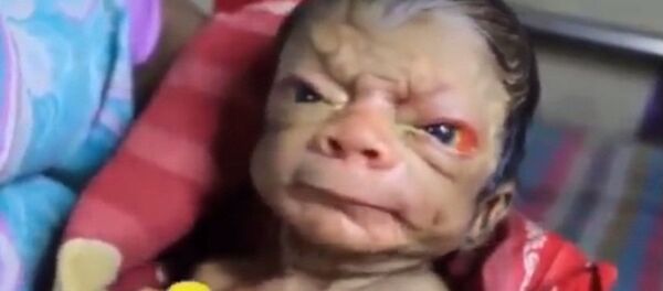 الطفل العجوز - سبوتنيك عربي