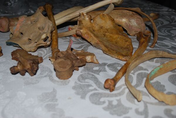 أعضاء بشرية - سبوتنيك عربي