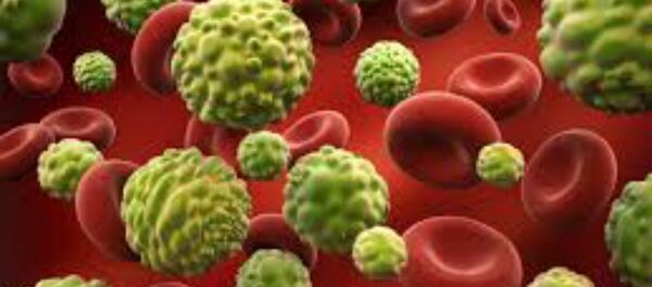 السرطان - سبوتنيك عربي