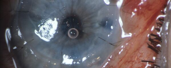 عيون حمراء - سبوتنيك عربي