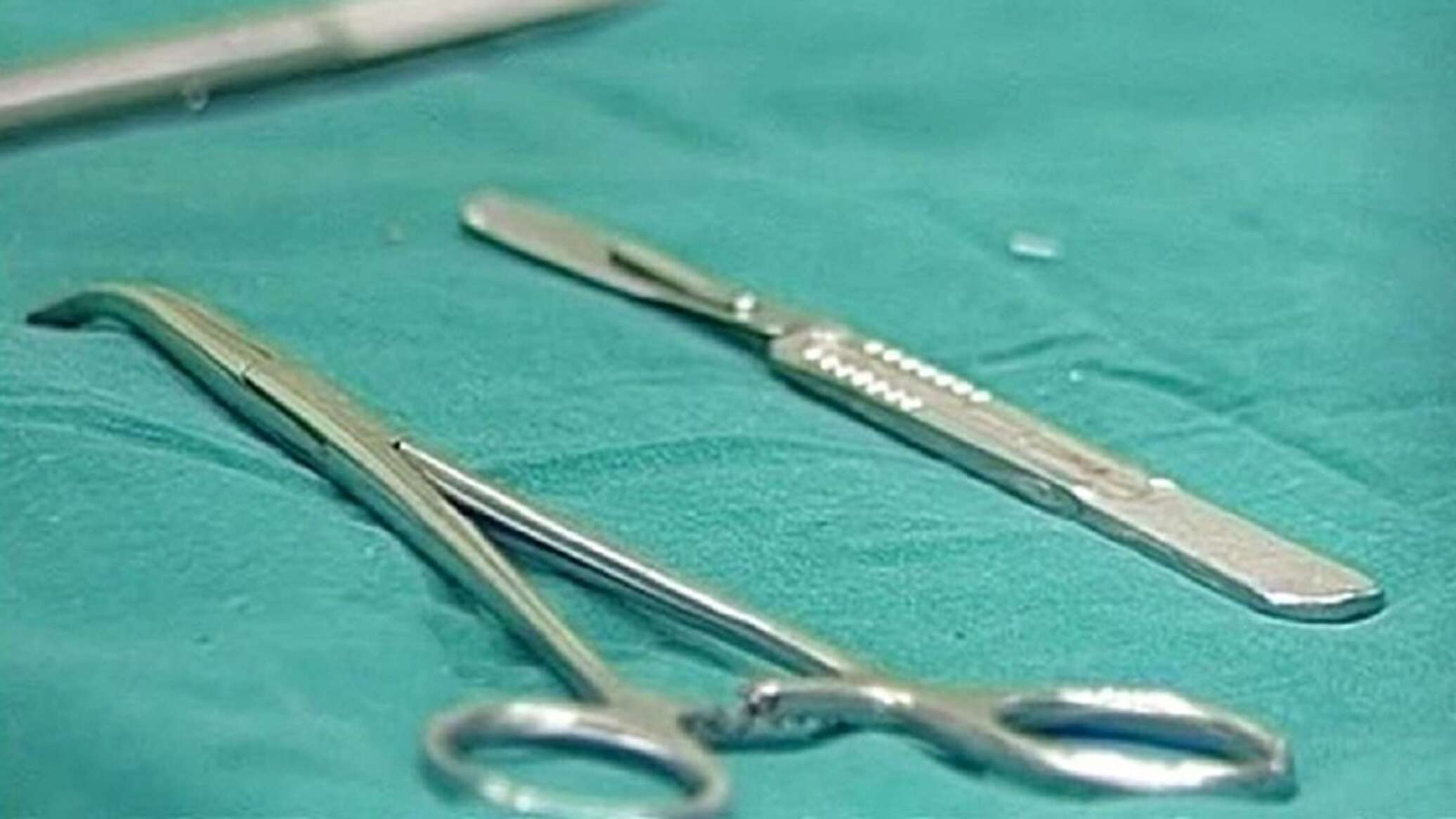 تركيا... طبيب ينسى مقصا في معدة مريضة لسنوات طويلة