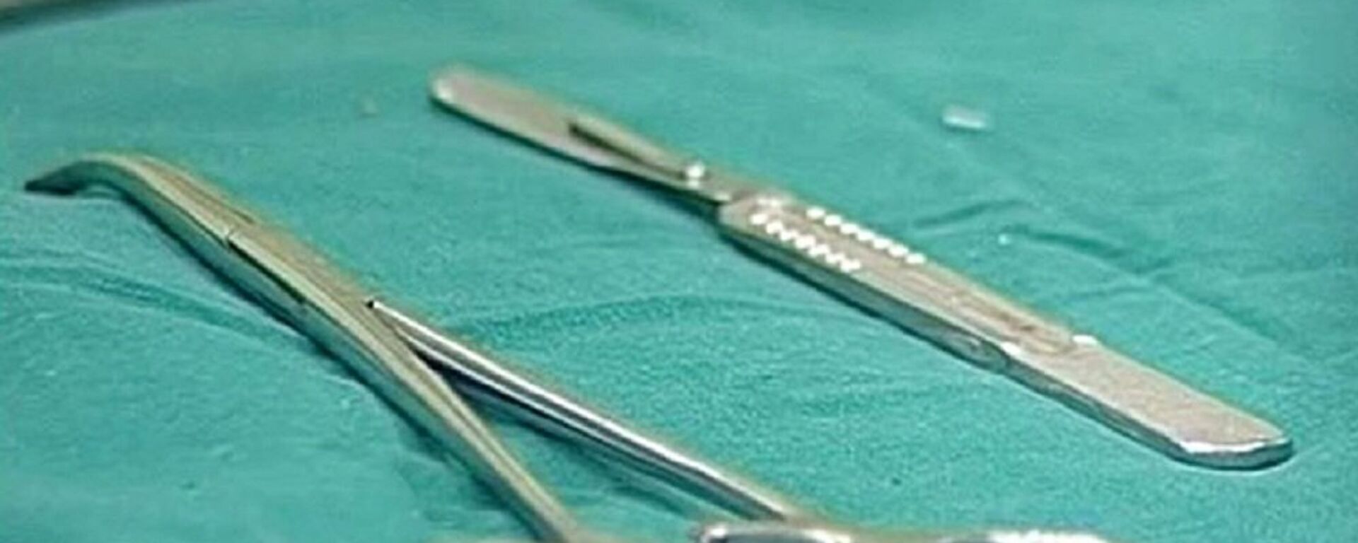 اخراج مقص من بطن مريض بعد 18 عاما - سبوتنيك عربي, 1920, 09.12.2024