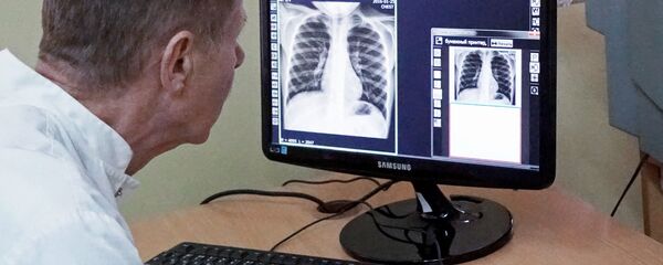 الرئتين - سبوتنيك عربي