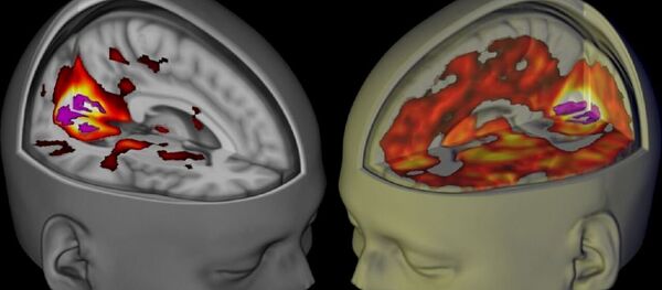 تأثير الفضاء على الدماغ البشري - سبوتنيك عربي