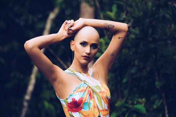 فتاة برازيلية تصبح مشهورة بغض النظر عن مرض السرطان - سبوتنيك عربي