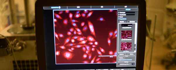 تبيان خلايا البروستاتا السرطانية - سبوتنيك عربي