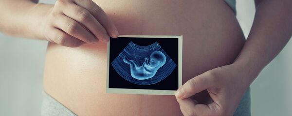 إمرأة حامل - سبوتنيك عربي