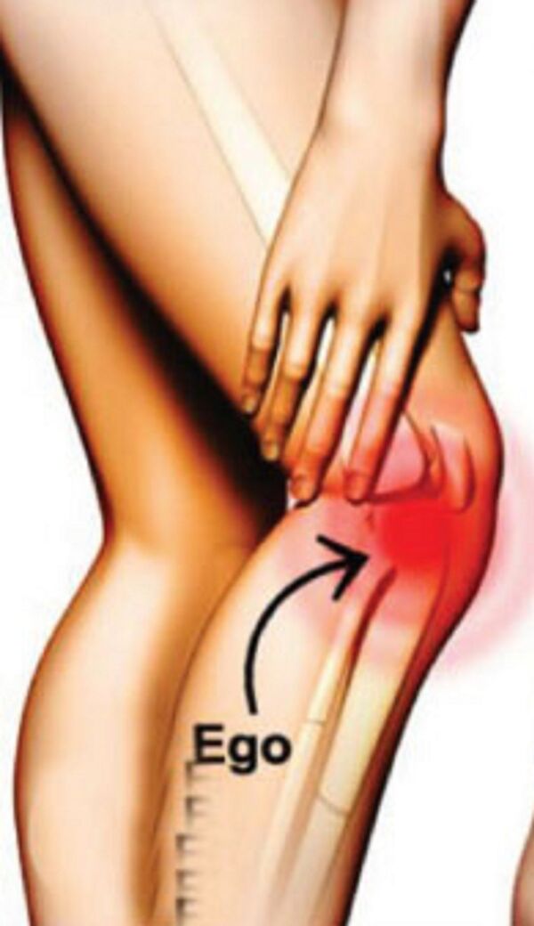 ألام الركبة - سبوتنيك عربي