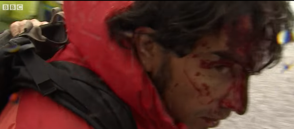 اصابة مراسل البي بي سي - سبوتنيك عربي