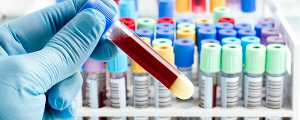 دم دم - سبوتنيك عربي