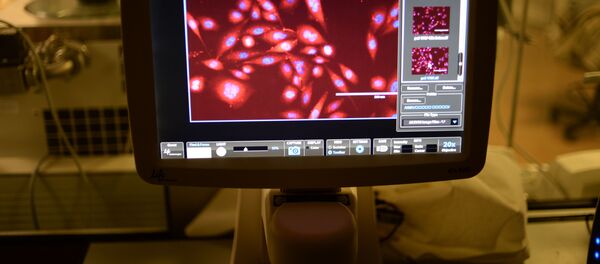 تبيان خلايا البروستاتا السرطانية تبيان خلايا البروستاتا السرطانية - سبوتنيك عربي