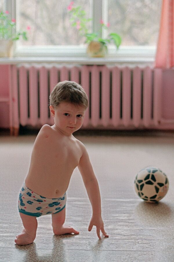 كارثة تشيرنوبيل - طفل ولد مصاب بالإعاقة بعد الكارثة، 4 أغسطس/ آب 1992 - سبوتنيك عربي