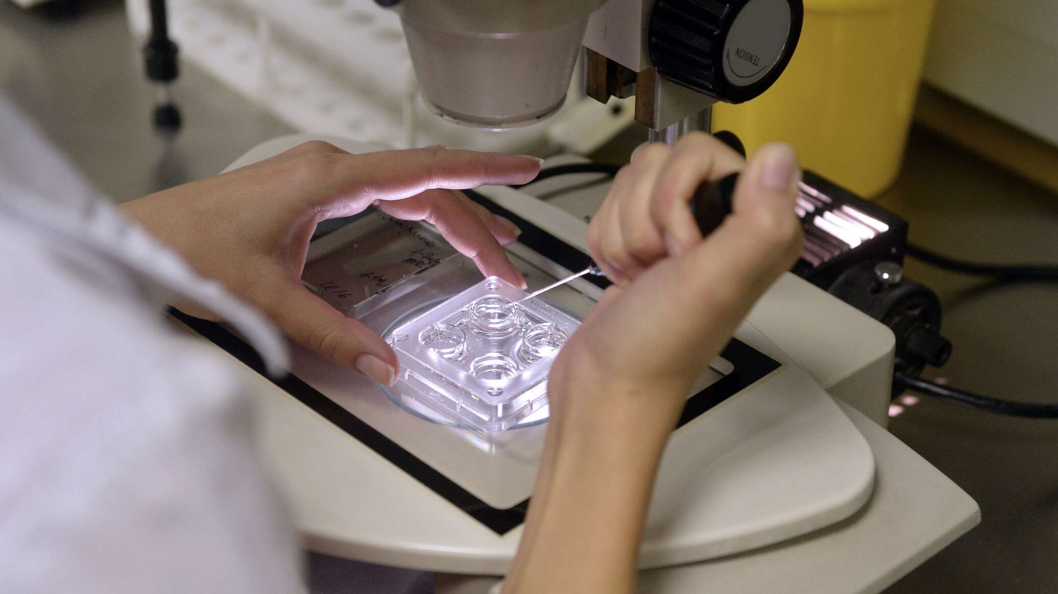 ارتفاع العقم لدى الرجال عالميا.. خبراء يكشفون الأسباب والحلول العلمية الحديثة